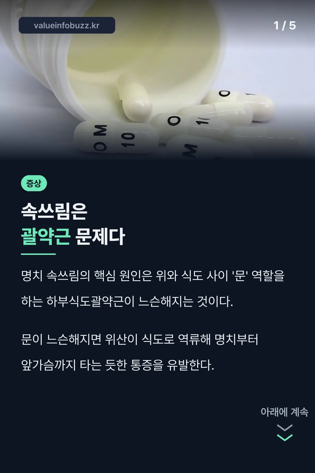 명치 속쓰림 괄약근 문제