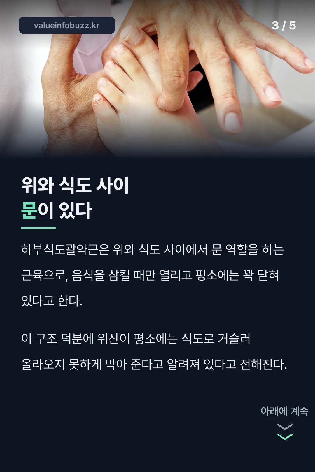 위와 식도 사이 문 구조
