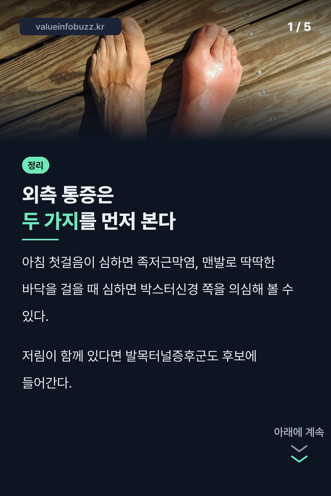 발바닥 외측통증 원인 두 가지