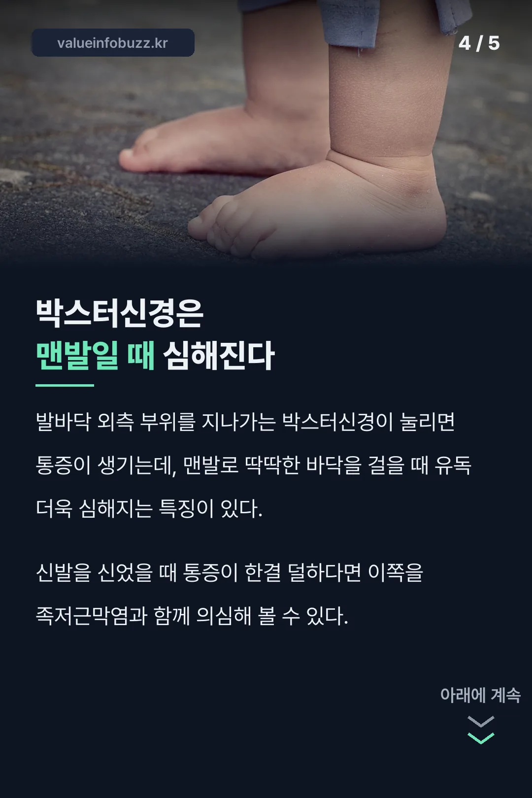 박스터신경 포착증후군
