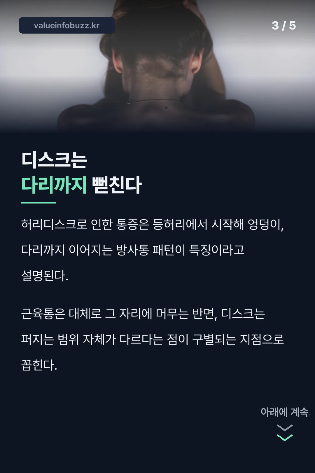 디스크는 다리까지 뻗친다는 방사통 특징