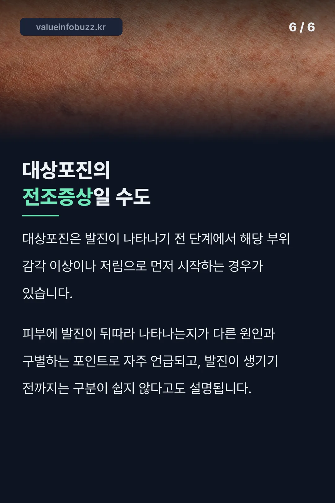 대상포진 전조증상 가능성